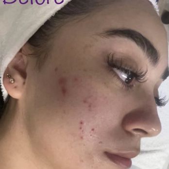 Beauteous Esthetics - Estheticians Near Me - Apple Valley, California Beauteous Esthetics - Estheticians Near Me - Apple Valley, California