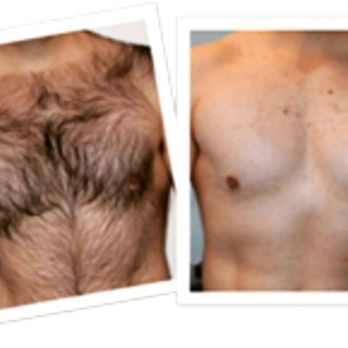 Kaesthetics Gold - Manscaping - Skin Care Near Me - Jamaica, New York Kaesthetics Gold - Manscaping - Skin Care Near Me - Jamaica, New York