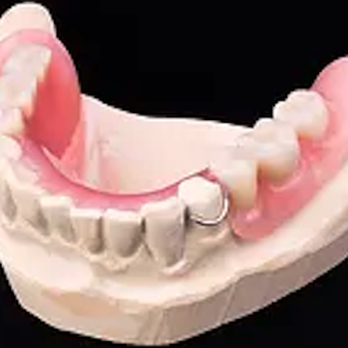 Carrasco Dental Clinic - Dentures - General Dentistry Near Me - Carson, California Carrasco Dental Clinic - Dentures - General Dentistry Near Me - Carson, California