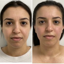 Glowmode Skincare - Neolift + Buccal Massage