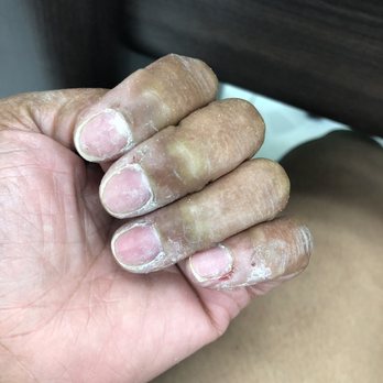 Eva Nails - Gel polish removed after mess up - Nail Salons Near Me - San Dimas, California Eva Nails - Gel polish removed after mess up - Nail Salons Near Me - San Dimas, California