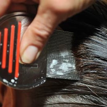 Lice Schmice - the Head Lice Experts - Altadena Lice Removal 626-208-7635 LICE SCHMICE - Lice Services Near Me Lice Schmice - the Head Lice Experts - Altadena Lice Removal 626-208-7635 LICE SCHMICE - Lice Services Near Me