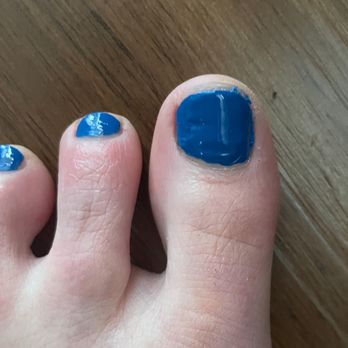 Snappy Nails & Spa - Fresh pedi!! Are you serious?! TERRIBLE JOB. - Nail Salons Near Me - Denver, Colorado Snappy Nails & Spa - Fresh pedi!! Are you serious?! TERRIBLE JOB. - Nail Salons Near Me - Denver, Colorado