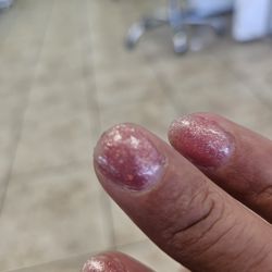 Pretty Nail Studio - Chipped gel nail after 2 days