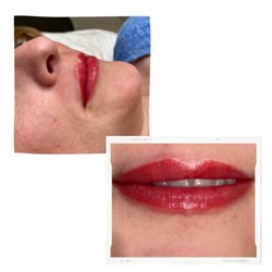 Pickture Perfect Medspa - Lip Blushing