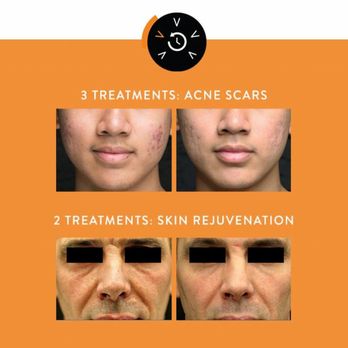 Skinetic Aesthetics - Achieve results with Viora IPL and Laser Skin Resurfacing - Skin Care Near Me - Las Vegas, Nevada Skinetic Aesthetics - Achieve results with Viora IPL and Laser Skin Resurfacing - Skin Care Near Me - Las Vegas, Nevada