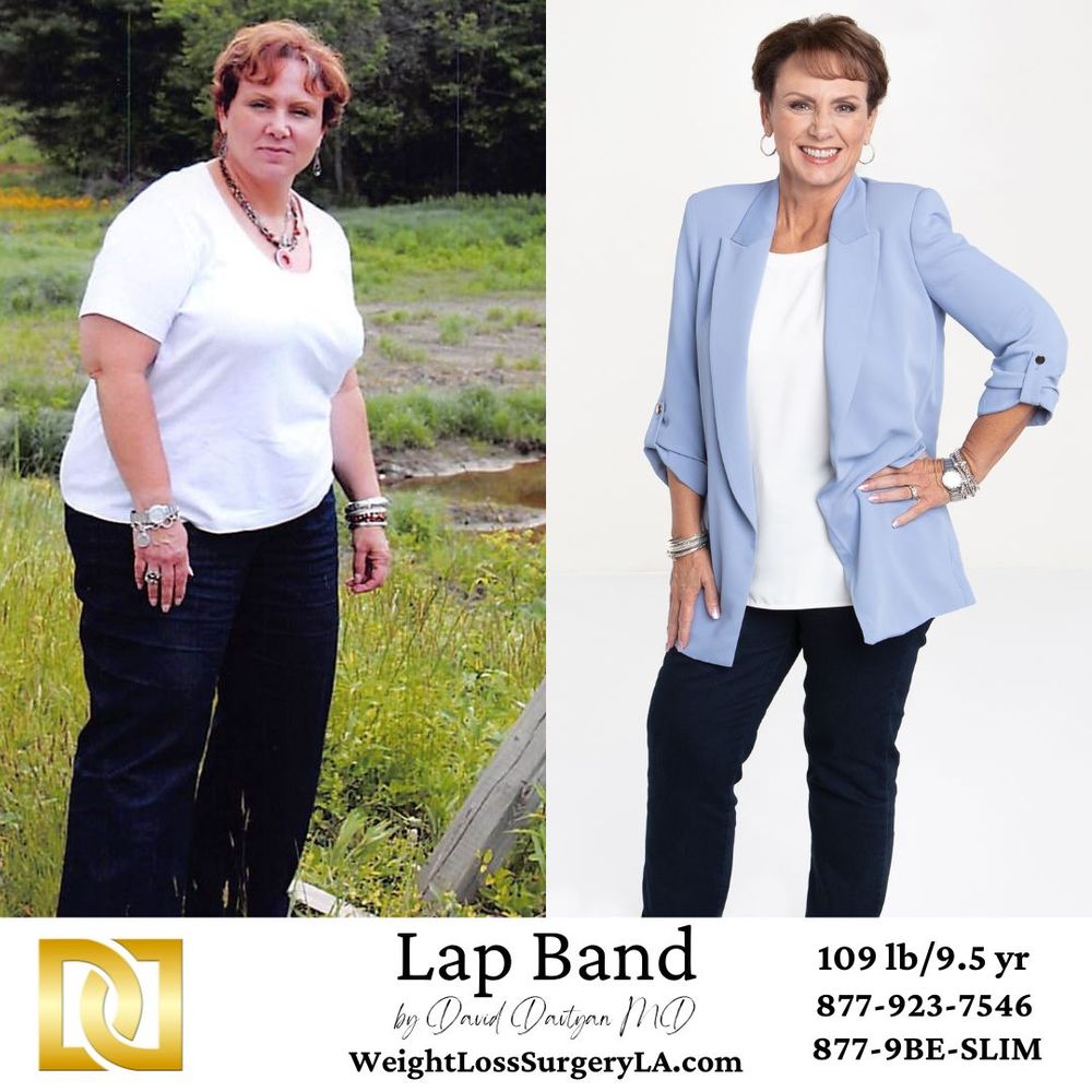 THE WEIGHT LOSS SURGERY CENTER OF LOS ANGELES Updated August 2024