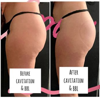 semaglutide bel air maryland PEACE & POISE STUDIOS - Updated June 2026 - 13 Photos - 5 Bel Air S Pkwy, Bel Air, Maryland - Weight Loss Centers - Phone Number