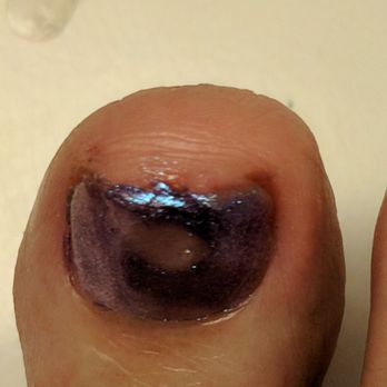 Luxury Nails & Spa - My toe is still bleeding from the pedicure - Nail Salons Near Me - Riverside, California Luxury Nails & Spa - My toe is still bleeding from the pedicure - Nail Salons Near Me - Riverside, California