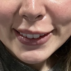 Ajliss Medical Aesthetics - San Dimas