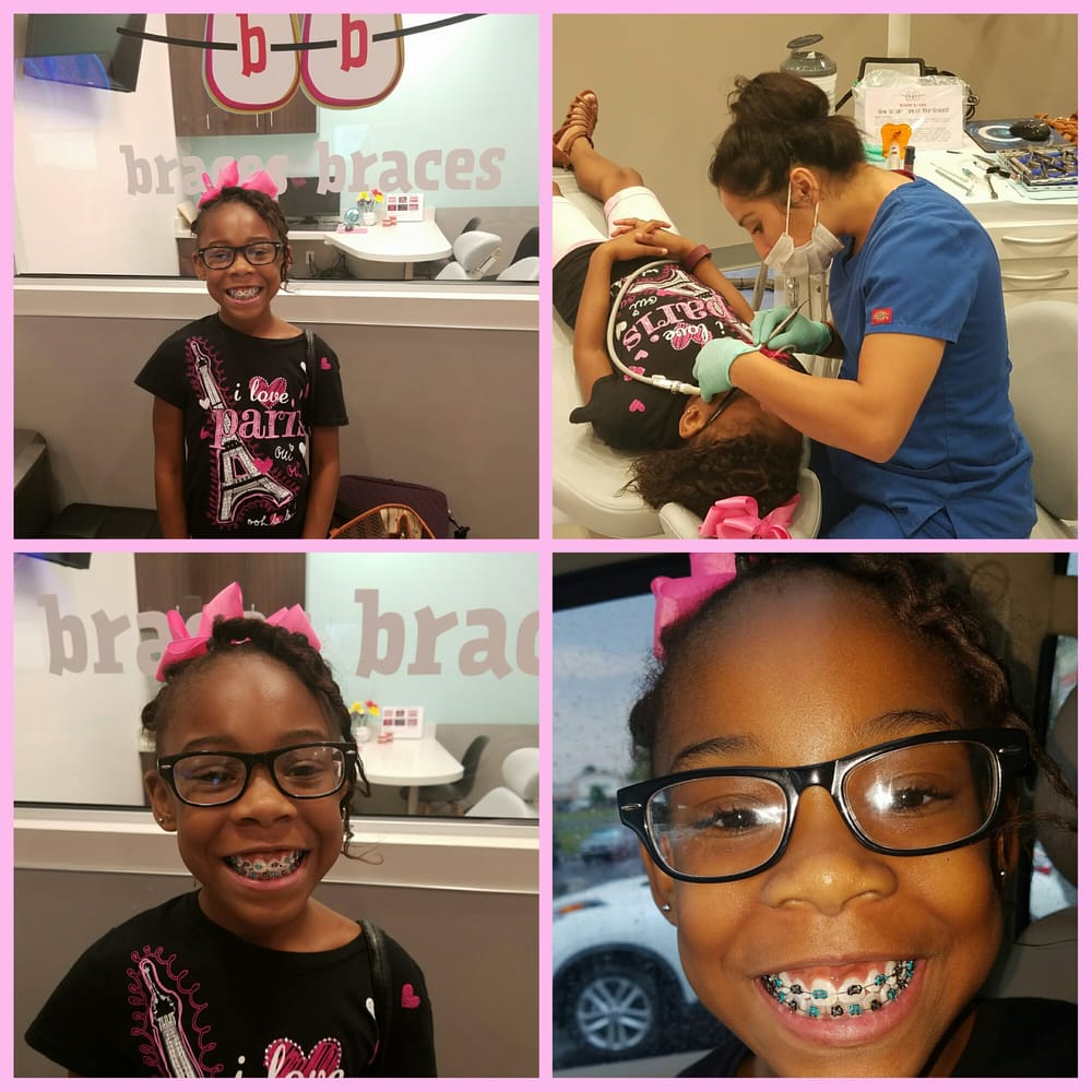BRACES BRACES Updated April 2024 3450 Cobb Pkwy, Acworth,