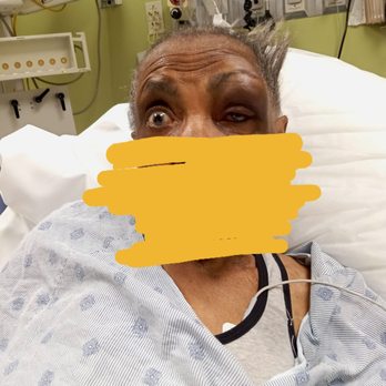 Grace Point Place - Mom's face after unexplained fall at Grace Point Place. - Assisted Living Facilities Near Me - Oak Lawn, Illinois