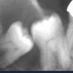 Oral and Maxillofacial Surgery Center