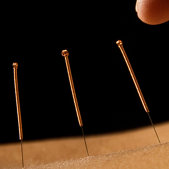 Eastern Wellness Acupuncture - Acupuncture Near Me - Scarsdale, New York Eastern Wellness Acupuncture - Acupuncture Near Me - Scarsdale, New York