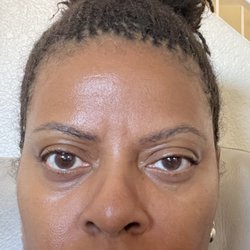 Pat's Eyebrow Threading - After the flakes...