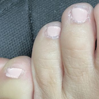 Venice Nail & Spa - Messy polish and skin painfully removed around nails. - Nail Salons Near Me - Buda, Texas Venice Nail & Spa - Messy polish and skin painfully removed around nails. - Nail Salons Near Me - Buda, Texas