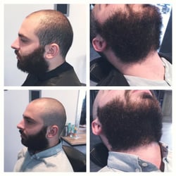Coralie A. - Avant / Après Rasage & restyling de barbe