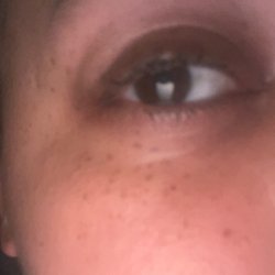 Elegant Skin Care - After I had to get Maggie' s extensions removed at another shop! No lashes left and they are horrendous