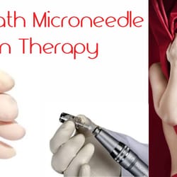 Los Reyes Clinica Medica - Blood Bath PRP Micro-needle Therapy