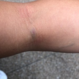 St. David’s Medical Center on Yelp