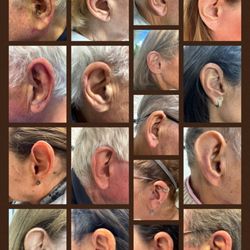 Flynn Associates - Ear of the month club. New hearing aid fittings