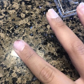 Rainbow Nails Spa - Bleeding from acrylic removal - Nail Salons Near Me - Sonoma, California Rainbow Nails Spa - Bleeding from acrylic removal - Nail Salons Near Me - Sonoma, California