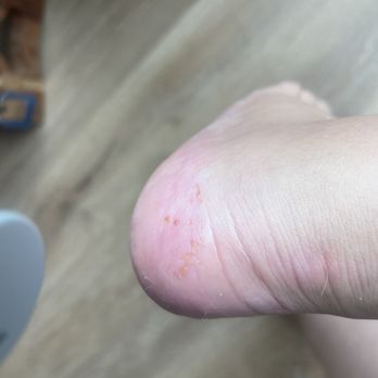 Sparkle & Pop Nails - Lady over scrubbed my left heel to the point it was red and bleeding and claimed that it's just part of the callus removal - Nail Salons Near Me - Arlington, Virginia