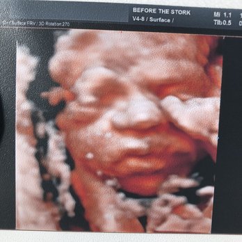 Before the Stork 4D - 27 weeks and 5 days - Ultrasound Imaging Centers Near Me - Anaheim, California Before the Stork 4D - 27 weeks and 5 days - Ultrasound Imaging Centers Near Me - Anaheim, California