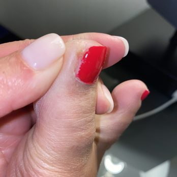 EM Beauty Nail Spa - Toe scabbing from going too deep under my nail. It's painful and still sore - Nail Salons Near Me - Millbrae, California EM Beauty Nail Spa - Toe scabbing from going too deep under my nail. It's painful and still sore - Nail Salons Near Me - Millbrae, California