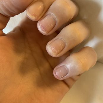 Classy Nails & Spa - My pinky nail was throbbing since the tips of my nail was ripped off from the nail. My middle nail is bruised underneath. PAINFUL - Nail Salons Near Me - New Lenox, Illinois