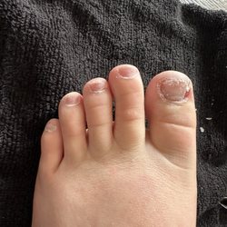 Lovely Nails - Damaged nails.