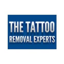 Tattoo Removal Experts