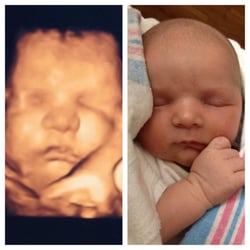 Prenatal Imaging