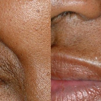 Green Clinic - laser hair removal - Skin Care Near Me - Toronto, Ontario Green Clinic - laser hair removal - Skin Care Near Me - Toronto, Ontario