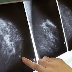 Advanced Obstetrics & Gynecology