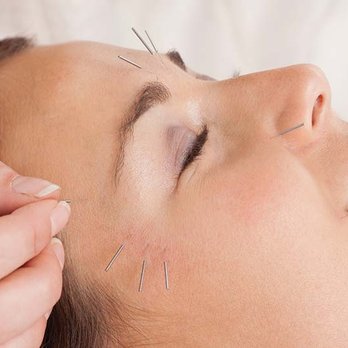 ACA Acupuncture & Wellness - facial rejuvenation - Acupuncture Near Me - Bayside, New York