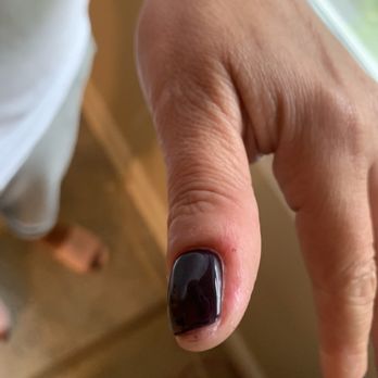 Top Nail Spa - BLOODY NAILS FROM THE TECHNICIAN. HURTS SO BAD. DONT COME HERE. - Nail Salons Near Me - Old Bridge, New Jersey Top Nail Spa - BLOODY NAILS FROM THE TECHNICIAN. HURTS SO BAD. DONT COME HERE. - Nail Salons Near Me - Old Bridge, New Jersey
