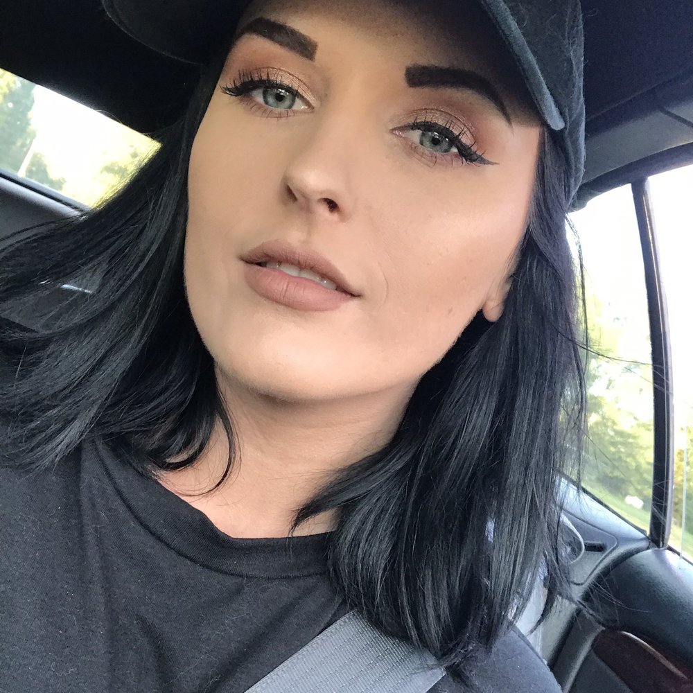 Privé Aesthetics - One and a half weeks after lips & undereyes! - Medical Spas Near Me - Dallas, Texas Privé Aesthetics - One and a half weeks after lips & undereyes! - Medical Spas Near Me - Dallas, Texas