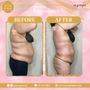 Inscape Body Aesthetics