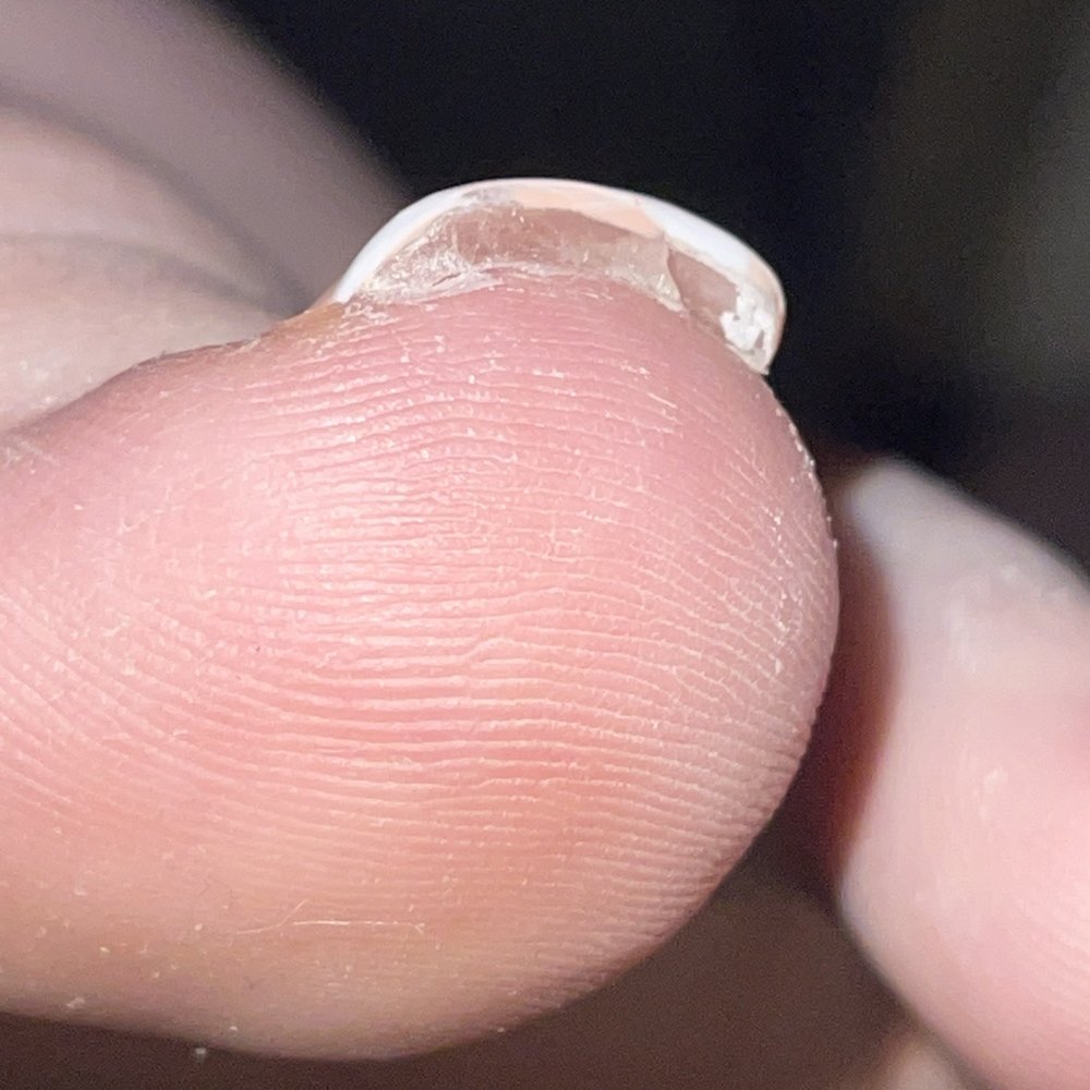 Le Belle Nails & Spa - underside of my other big toe - Day Spas Near Me - Bay Shore, New York Le Belle Nails & Spa - underside of my other big toe - Day Spas Near Me - Bay Shore, New York
