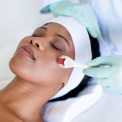 Amber’s Aesthetics & Permanent Makeup - Collagen Induction Therapy