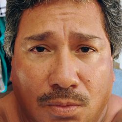 Picou Keith A Clinic - This photo wants to ask, Ing Lion, is pay tendered!?? Must go Manhattan Beach New York Times New York Manhattan. The esophagus throat well.
