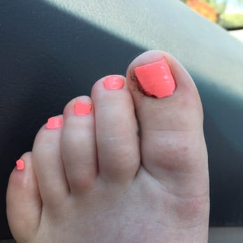 Jenny Nails Too - The lady cut my toe and superglued it and it looks gross!! - Nail Salons Near Me - Seattle, Washington Jenny Nails Too - The lady cut my toe and superglued it and it looks gross!! - Nail Salons Near Me - Seattle, Washington