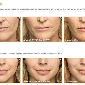 Lucali Aesthetic Medicine - Temecula Botox Wrinkle Removal Face Neck Tightening Fillers Ultherapy - Skin Care Near Me - Murrieta, California Lucali Aesthetic Medicine - Temecula Botox Wrinkle Removal Face Neck Tightening Fillers Ultherapy - Skin Care Near Me - Murrieta, California