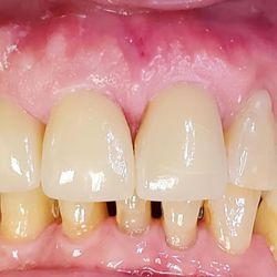 Thomas Yoon Dental