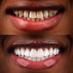 Dental Design Smile Miami