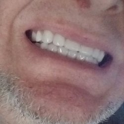 R M Mulchandani, DDS - Perfection