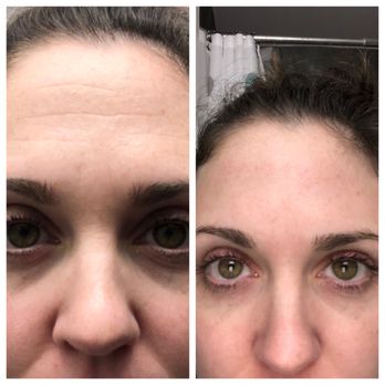 Pure Excellence Esthetics - Skin Care Near Me - Lone Tree, Colorado Pure Excellence Esthetics - Skin Care Near Me - Lone Tree, Colorado
