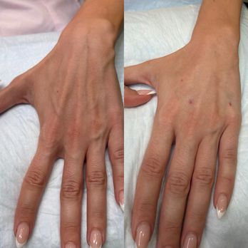 DermaPrecision - Medical Spas Near Me - Scottsdale, Arizona DermaPrecision - Medical Spas Near Me - Scottsdale, Arizona