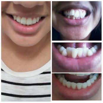 Jagruti A. Thakkar, DDS - General Dentistry Near Me - Riverside, California Jagruti A. Thakkar, DDS - General Dentistry Near Me - Riverside, California